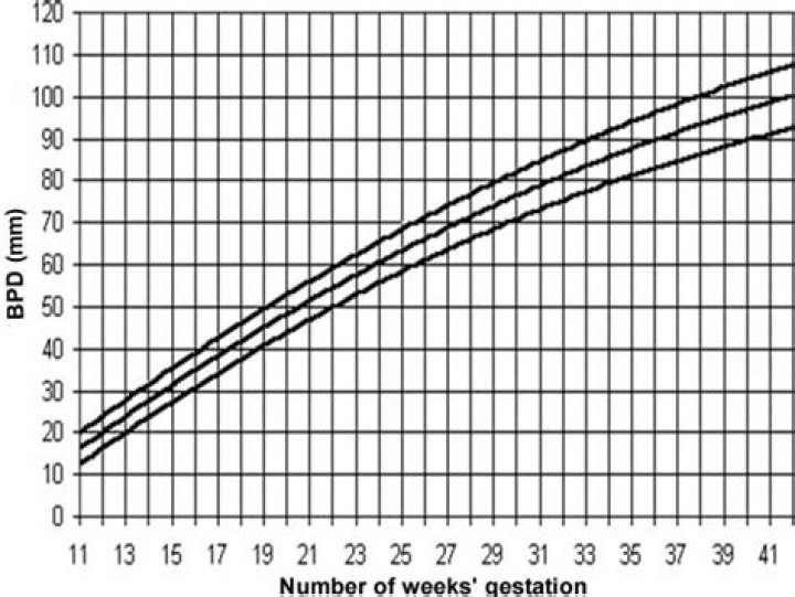 Accuracy of BPD for Dating the Pregnancy