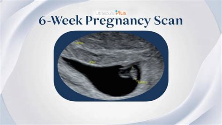At 6 weeks
