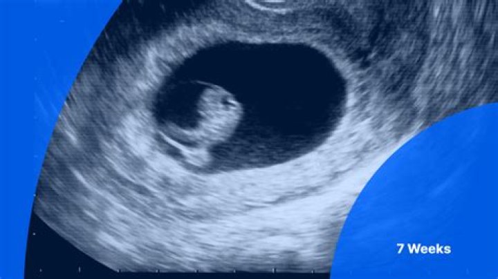 At 7 weeks