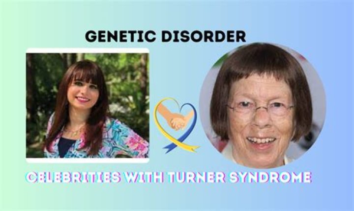 Discover The Inspiring World Of Turner Syndrome Celebrities