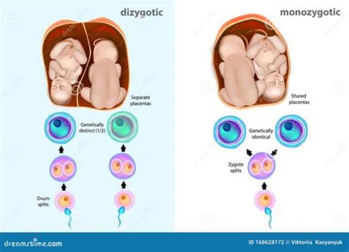 Dizygotic Twins