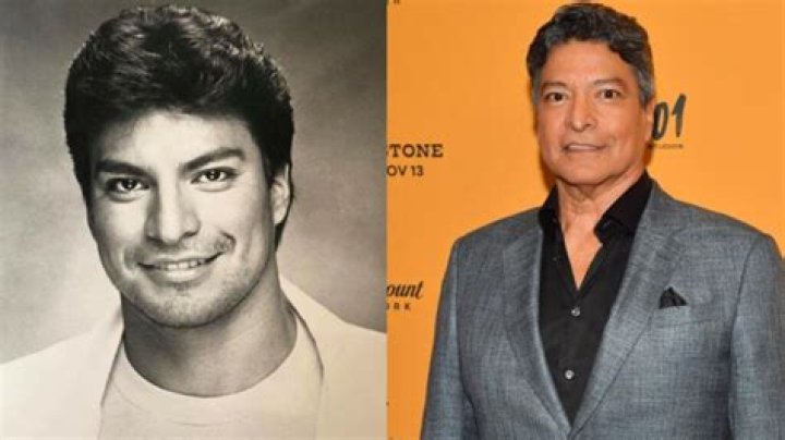 Gil Birmingham's Plastic Surgery Journey Explored
