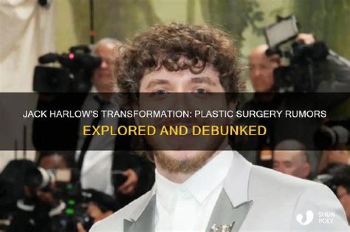 Jack Harlow's Transformation Revealed: From Boy To Icon