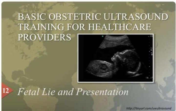 Presentation on Ultrasound