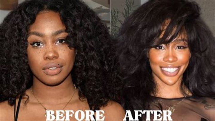 SZA Before Plastic Surgery Exposed