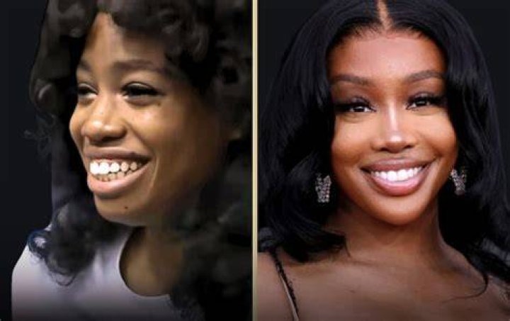 Unveiling SZA's Vocal Journey: Discoveries Before Surgery